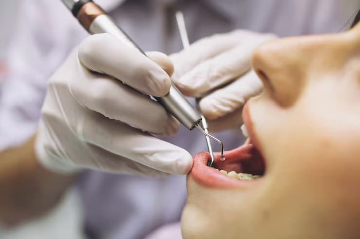 The benefits and risks of dental crowns: Is it the right choice for you?