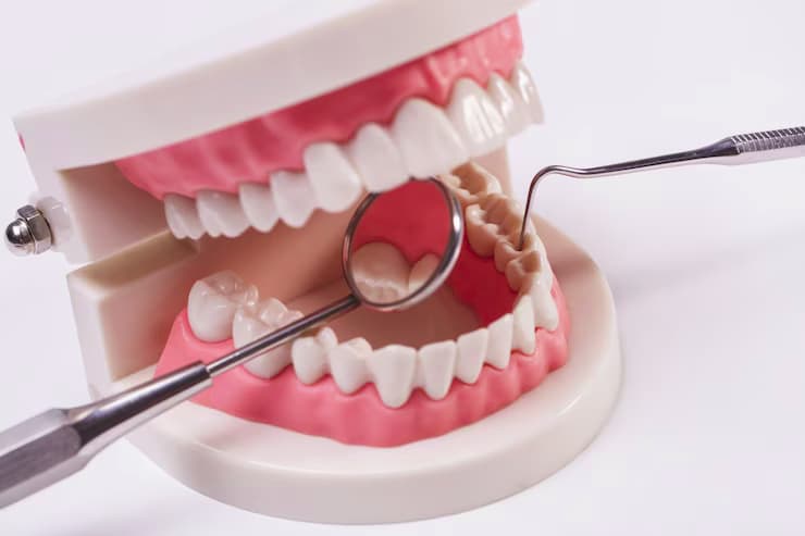 Are Dental Implants Right for You? Factors to Consider Before Getting Implants in Dubai